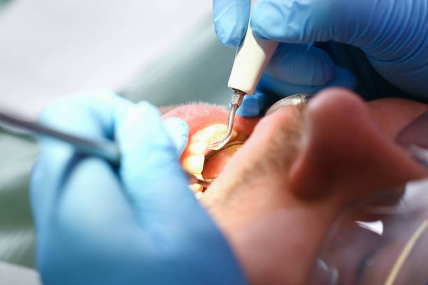 Best Emergency Gum Treatment in Venus, TX