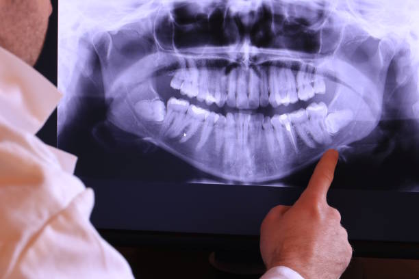 Best Emergency Tooth Extraction in Venus, TX