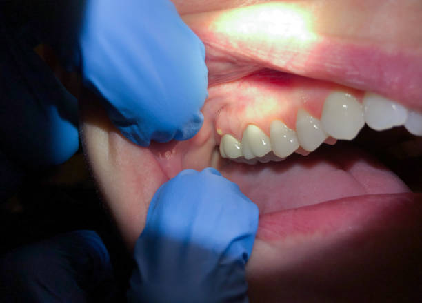 Best Emergency Root Canal Treatment in Venus, TX